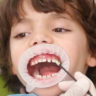 Способы восстановления зубов у детей