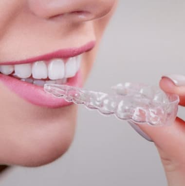 Виды восстановления зубной эмали